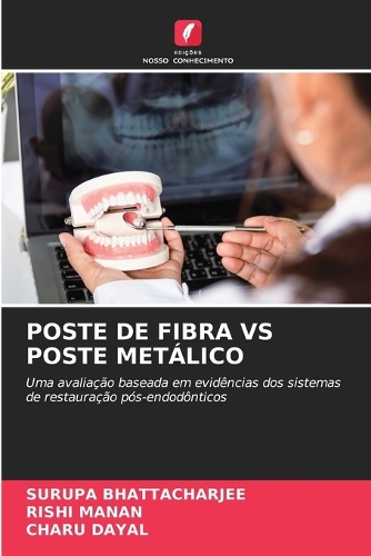 Poste de Fibra Vs Poste Metálico