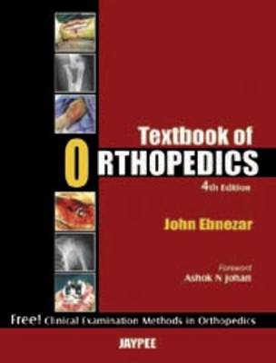 Textbook of Orthopedics