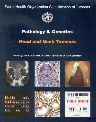 Pathology and genetics of head and neck tumours