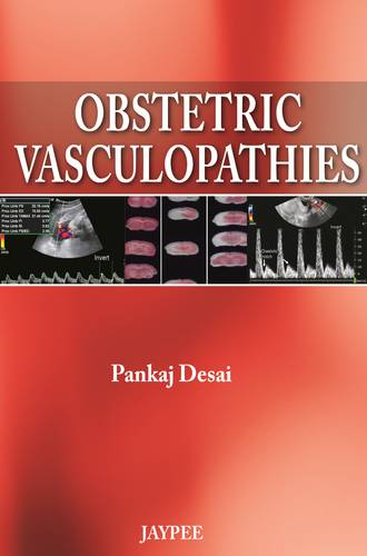 Obstetric Vasculopathies