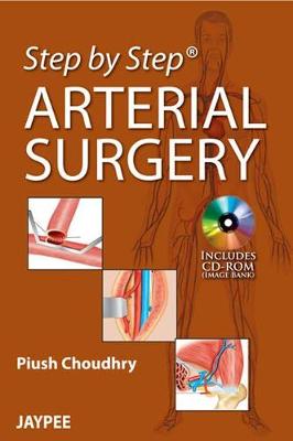 Step by Step: Arterial Surgery