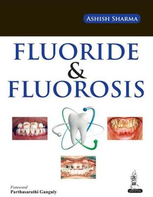 Fluoride and Fluorosis