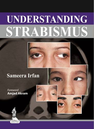 Understanding Strabismus