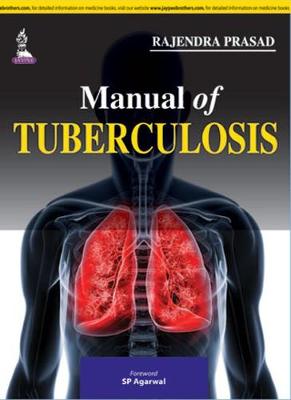 Manual of Tuberculosis