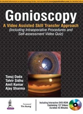 Gonioscopy