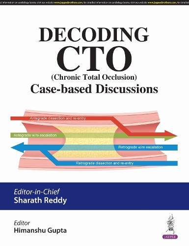 Decoding CTO (Chronic Total Occlusion)