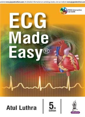 ECG Made Easy
