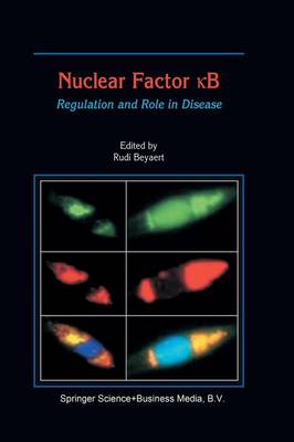 Nuclear Factor кB