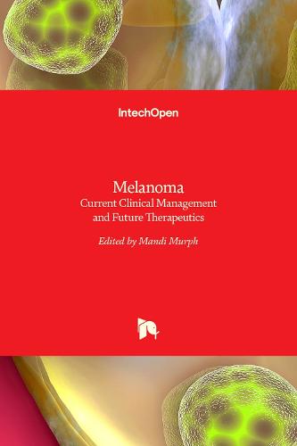Melanoma