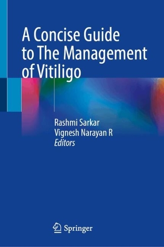 A Concise Guide to The Management of Vitiligo