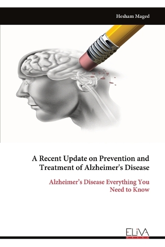 A Recent Update on Prevention and Treatment of Alzheimer's Disease