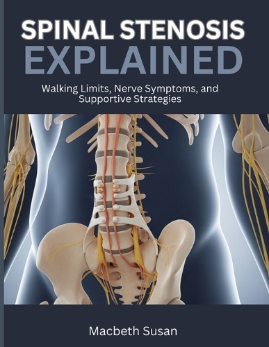 Spinal Stenosis Explained