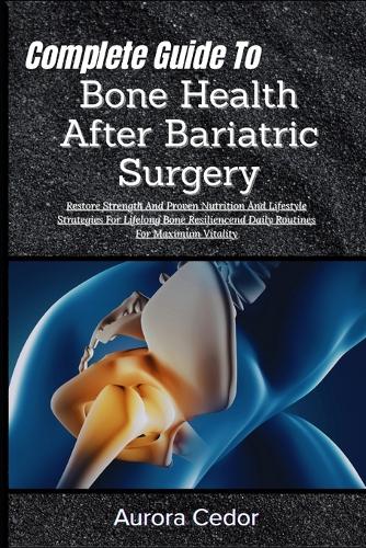 Complete Guide To Bone Health After Bariatric Surgery