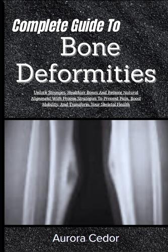 Complete Guide To Bone Deformities