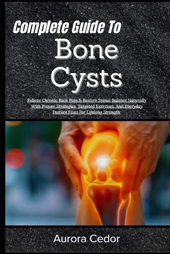 Complete Guide To Bone Cysts