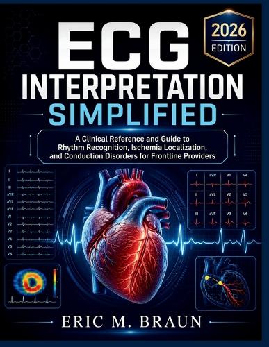 ECG Interpretation Simplified