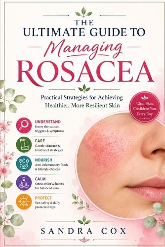 The ultimate guide to managing rosacea