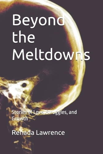 Beyond the Meltdowns