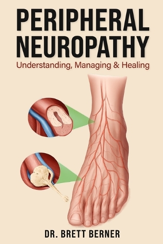 Peripheral Neuropathy