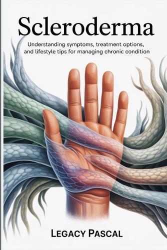 Overcoming Scleroderma