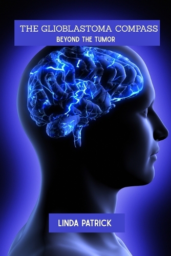 The glioblastoma compass