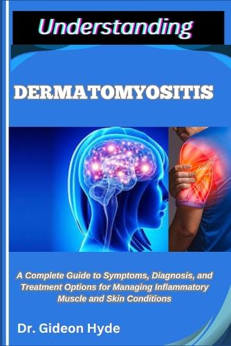 Understanding Dermatomyositis