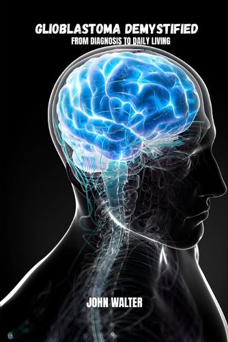 Glioblastoma demystifyied