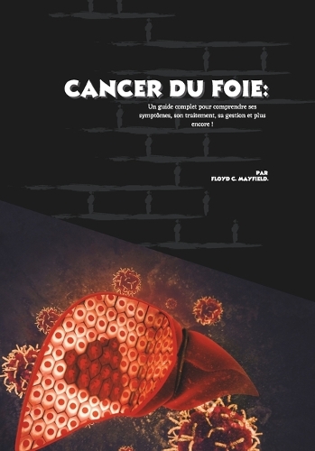Cancer du foie
