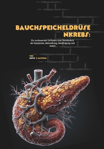 Bauchspeicheldrüsenkrebs
