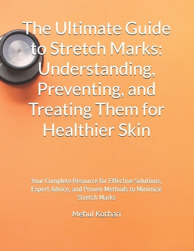 The Ultimate Guide to Stretch Marks