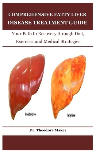 Comprehensive Fatty Liver Disease Treatment Guide