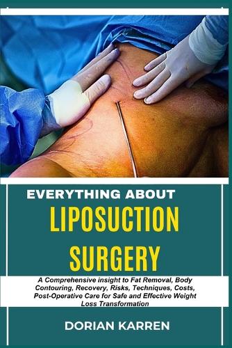 Everything about Liposuction Surgery
