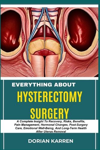 Everything about Hysterectomy Surgery