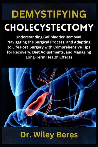 Demystifying Cholecystectomy