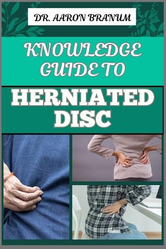 Knowledge Guide to Herniated Disc