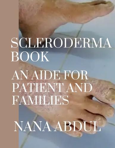 Scleroderma book
