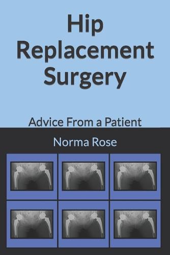 Hip Replacement Surgery