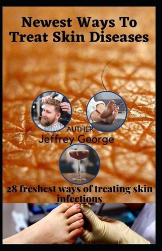 Newest Ways To Treat Skin Diseases
