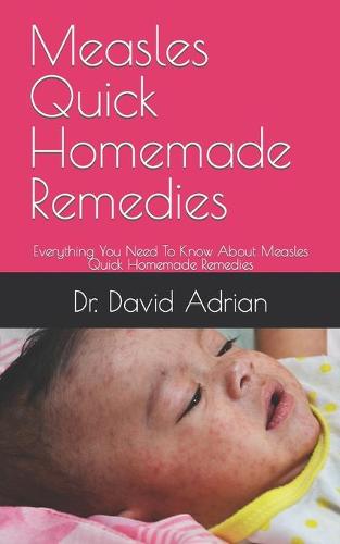 Measles Quick Homemade Remedies
