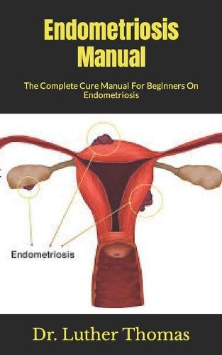Endometriosis Manual