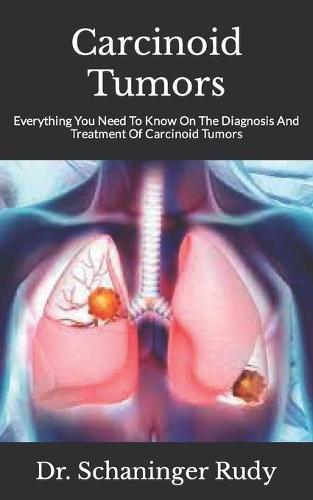 Carcinoid Tumors