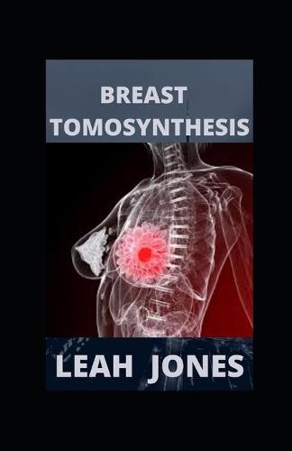 Breast Tomosynthesis
