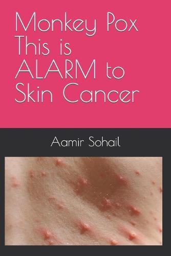 Monkey Pox This is ALARM to Skin Cancer