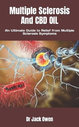 Multiple Sclerosis And CBD OIL