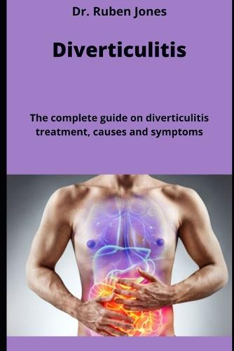 Diverticulitis