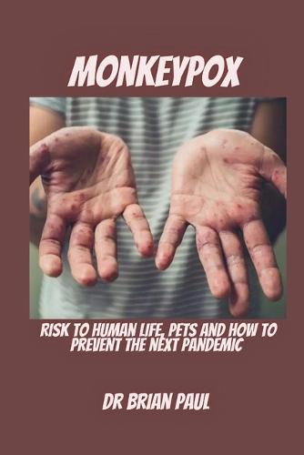 Monkeypox