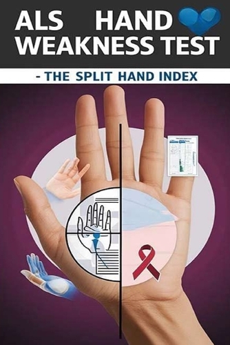 ALS Hand Weakness Test - The Split Hand Index