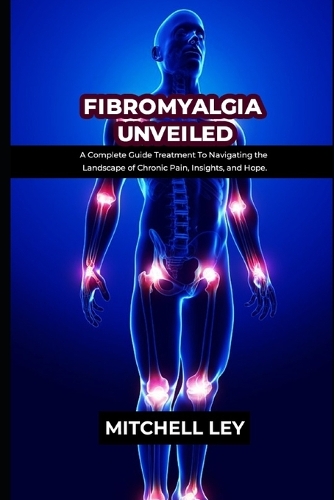 Fibromyalgia Unveiled