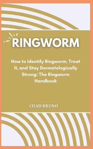 Ringworm
