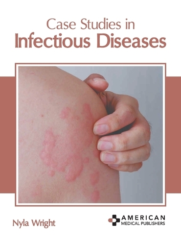 Case Studies in Infectious Diseases